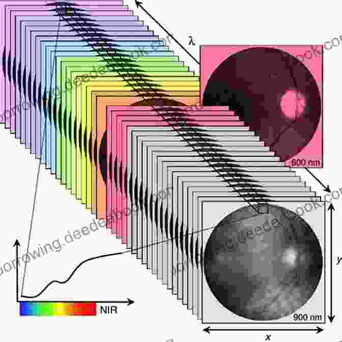 SLP Imaging Measures The Polarization Of Light Reflected From The Retina To Assess Nerve Fiber Damage Glaucoma Imaging Hector Gonzalo