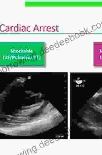Essential Echocardiography: Transesophageal Echocardiography For Non Cardiac Anesthesiologists